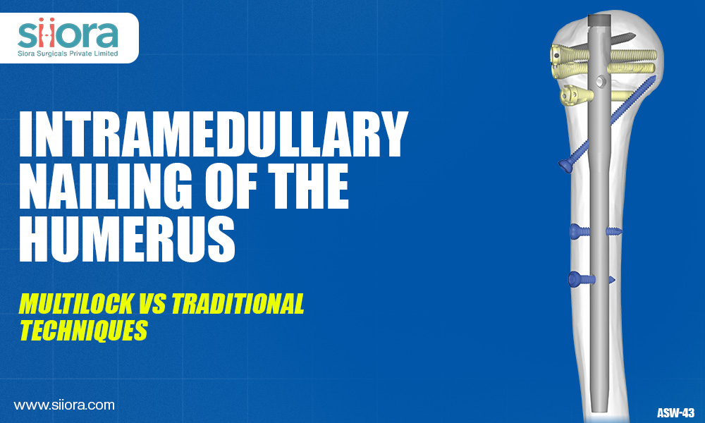 Intramedullary Nailing of the Humerus: Multilock vs Traditional&nbsp;Techniques