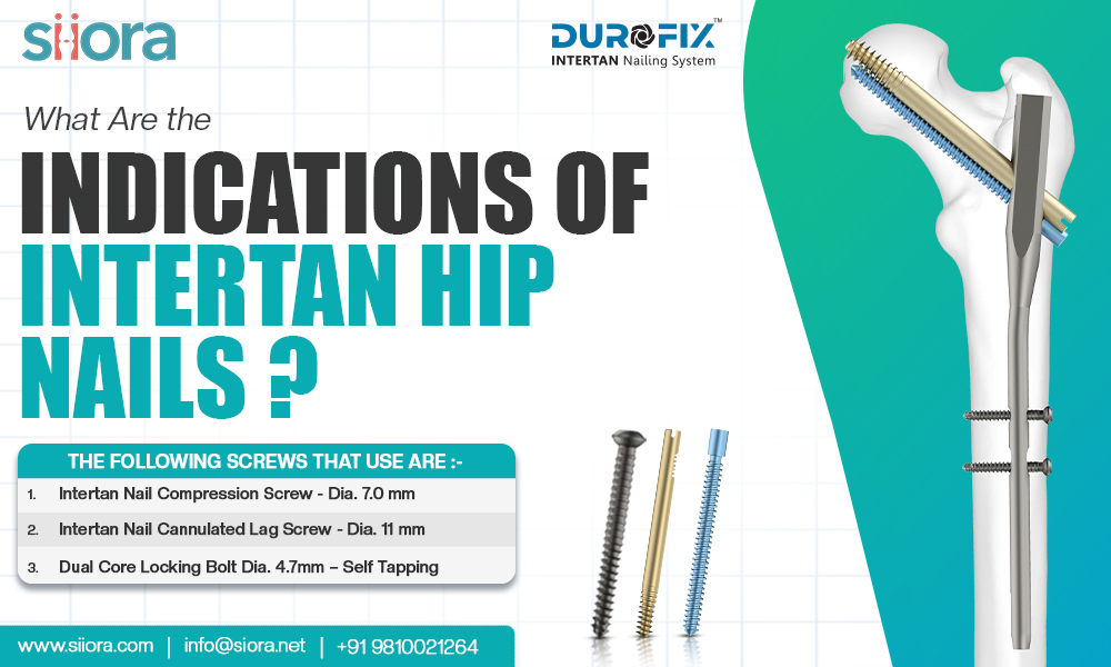 What Are the Indications of Intertan Hip&nbsp;Nails?